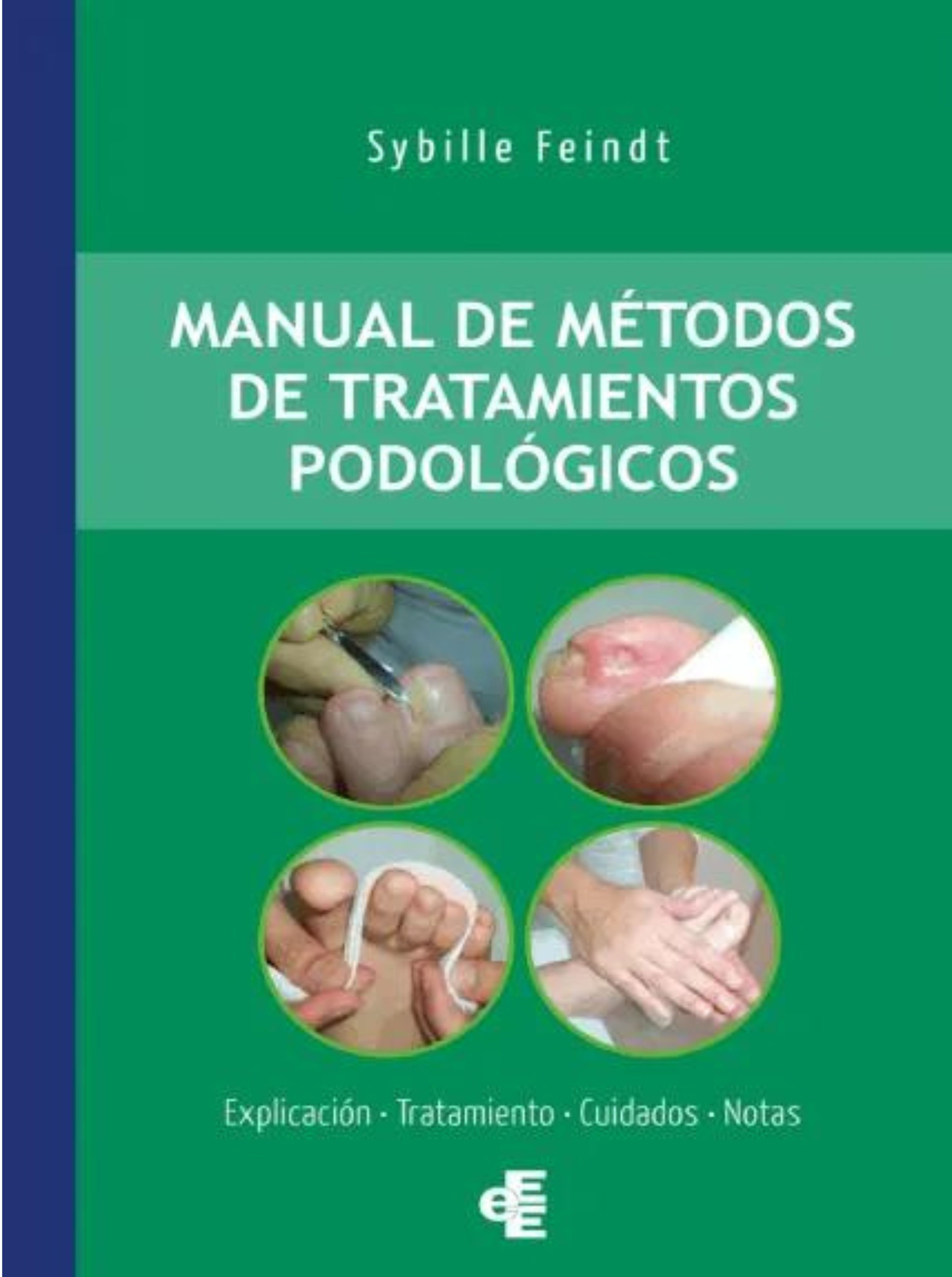 Métodos de tratamientos podológicos