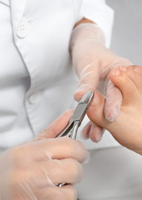 Close up of a chiropodist’s hands doing chiropody in her podiatry clinic. The chiropodist is cutting the patient’s nails with specialized scissors Close up of a chiropodist's hands doing chiropody in her podiatry clinic. The chiropodist is cutting the patient's nails with specialized scissors